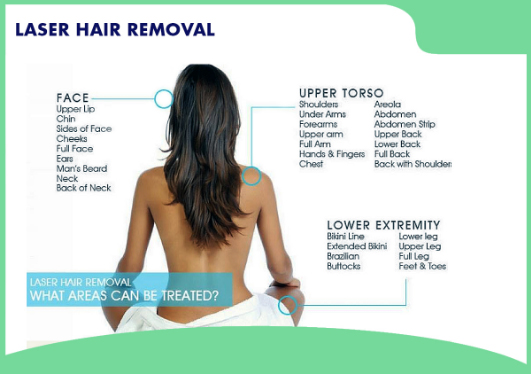 Upper Back Laser Hair Removal for Women